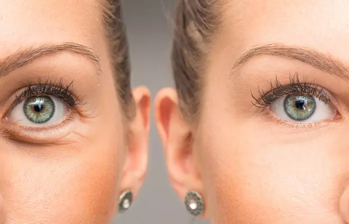 4. Rejuvenate Puffy Eyes