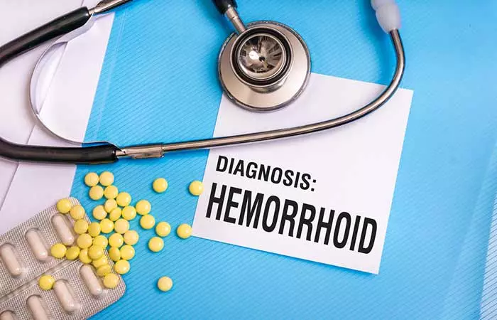 Too Late, I Have Hemorrhoids. How Do I Treat It
