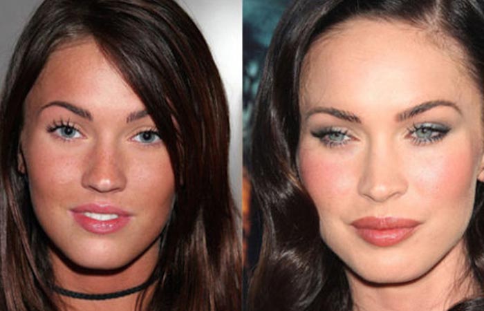 Hollywood Celebrity Megan Fox Before and After Plastic Suregery