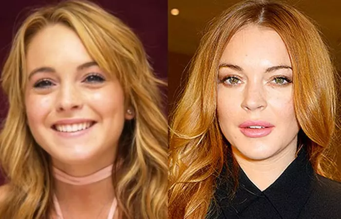 Lindsay Lohan before and after nose job