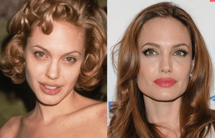 Top 25 Celebrities Before And After Plastic Surgery And Nose Jobs