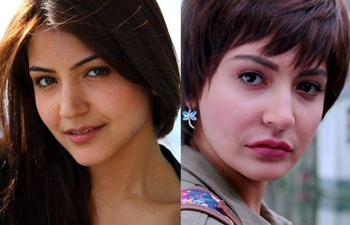 Top 25 Celebrities Before And After Plastic Surgery And Nose Jobs