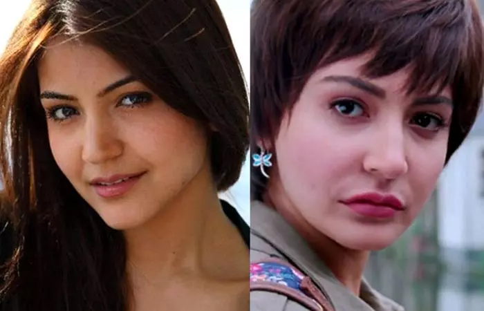 Anushka Sharma before and after nose job