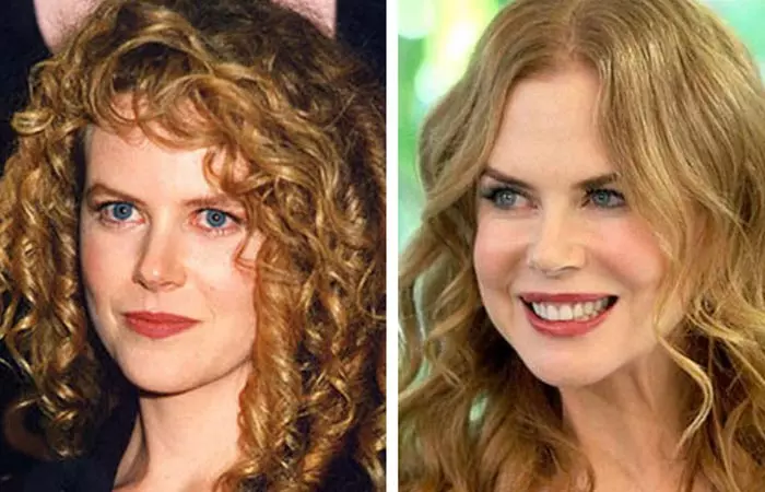 Nicole Kidman before and after nose job