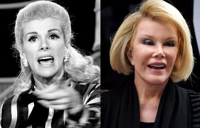 Joan Rivers before and after nose job