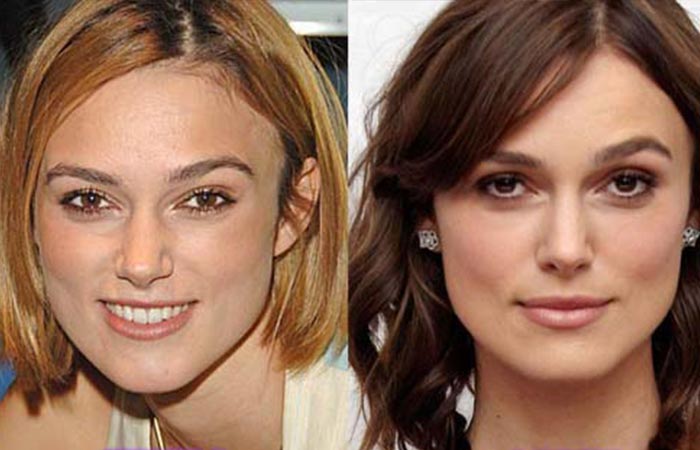 Actors Before and After Nose Job Top 25 Celebrities Before And After Plastic Surgery And 