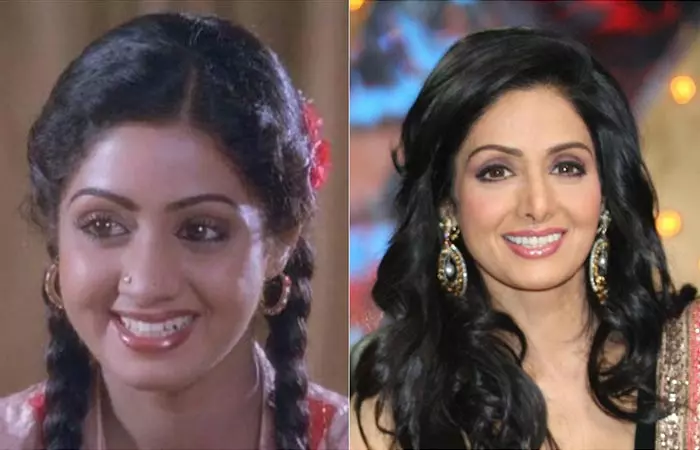 Sridevi before and after nose job