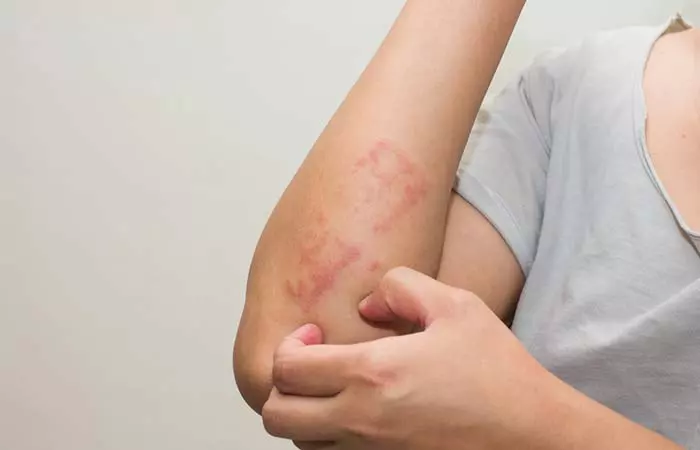 5.Added Risk If You Suffer From Skin Diseases