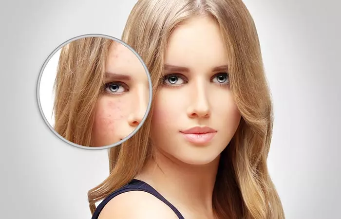 5.Eliminate-Dark-Spots