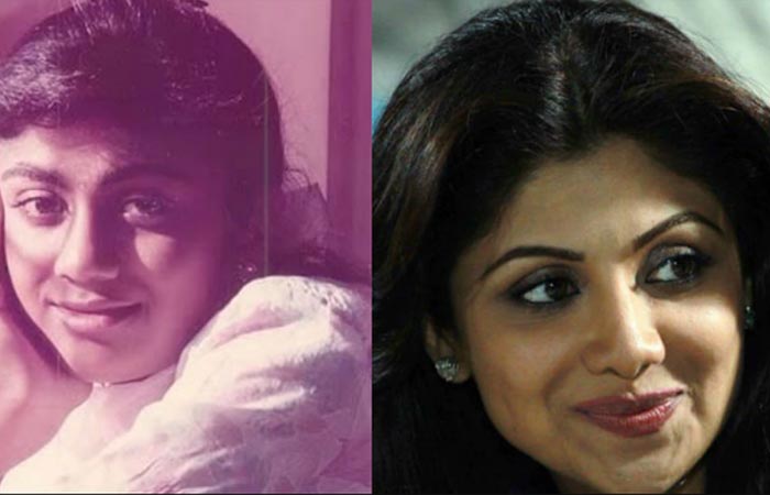Shilpa Shetty before and after nose job
