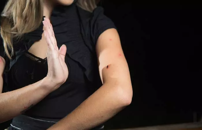 8. Mosquito Bites Driving You Insane Vicks VapoRub Can Preserve Your Sanity.