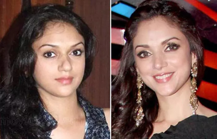 Aditi Rao Hydari Nose Job - Before and After Plastic Suregery