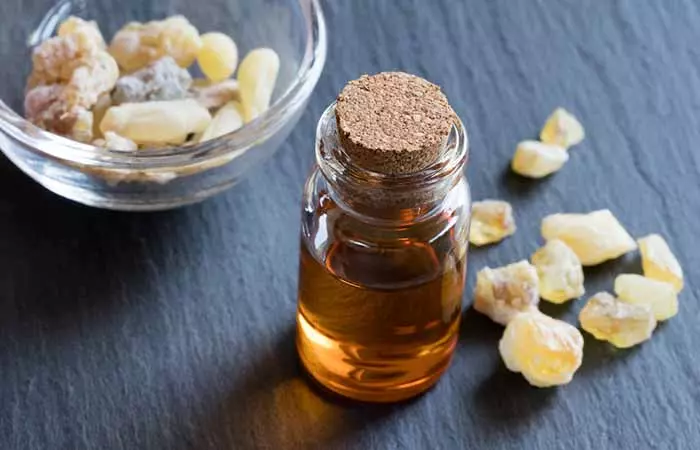 Frankincense oil to treat burns at home