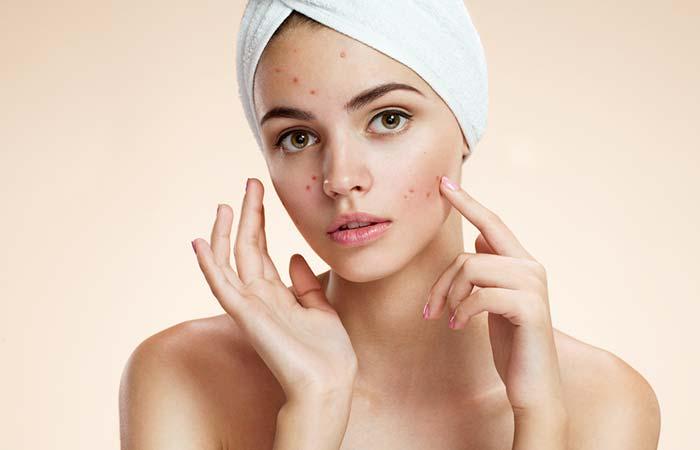11.Unhealthy Skin