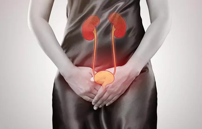 2. Frequent UTIs
