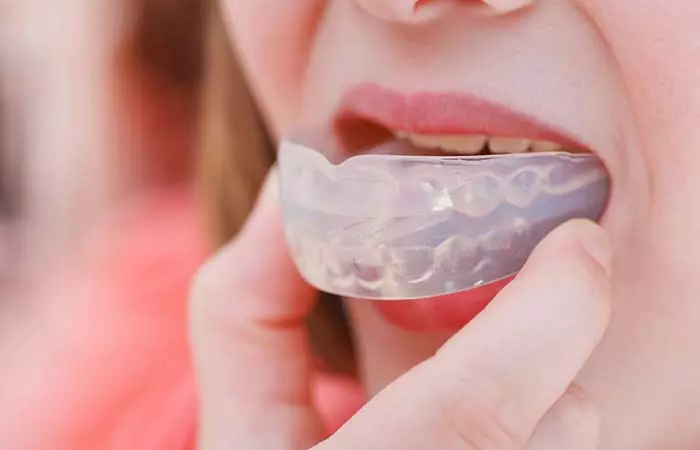Mouthguard to stop grinding teeth in your sleep
