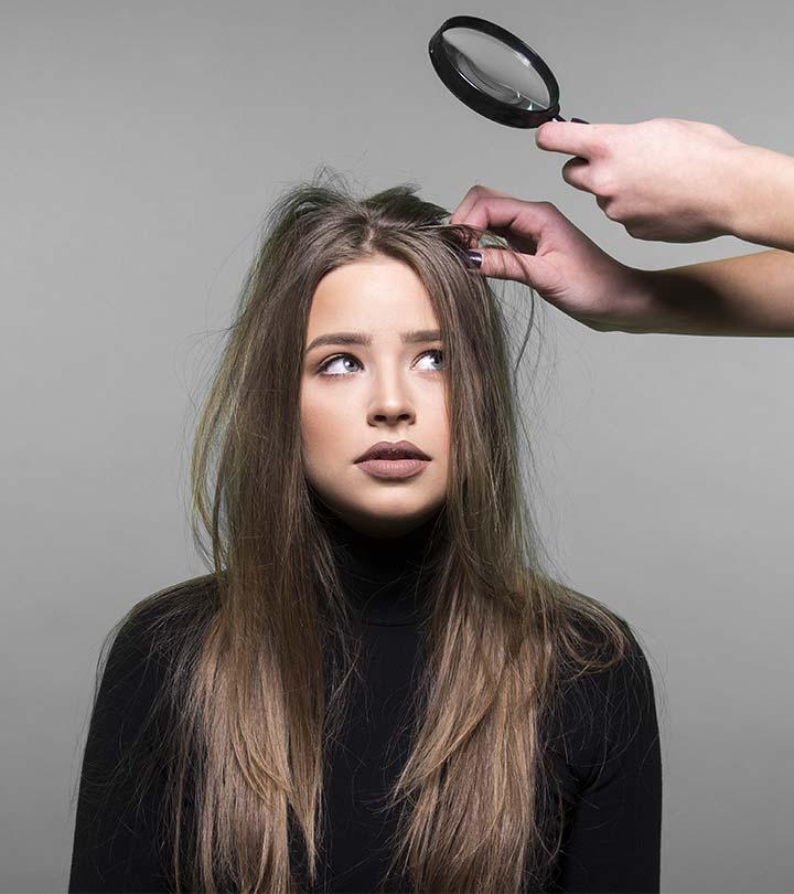 A women with dandruff and frizzy hair