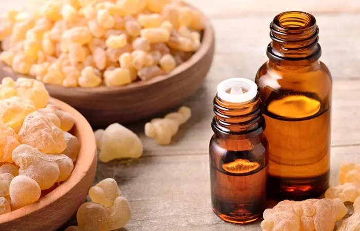 How to treat diaper rashes with frankincense essential oil