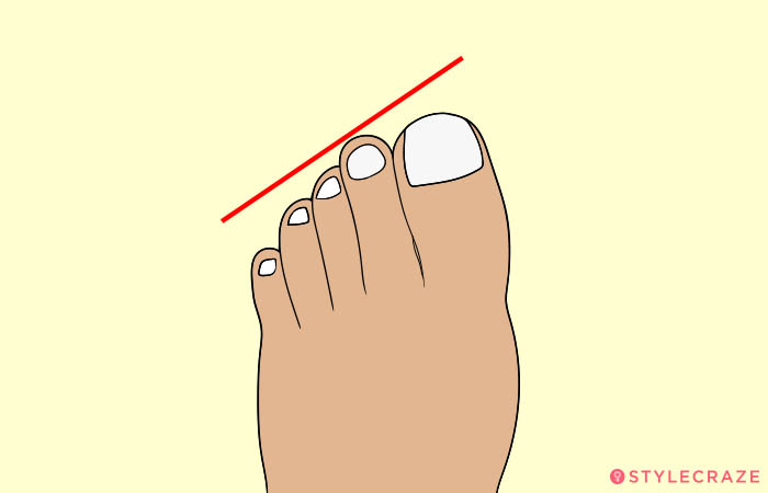 1. The Egyptian Toes
