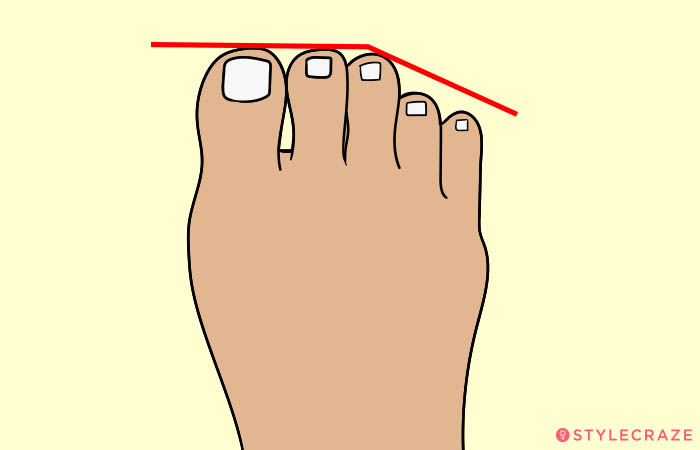 2. The Roman Toes