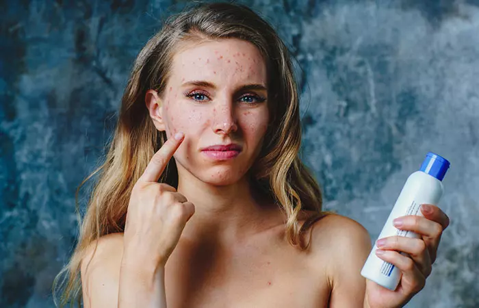 3.-Most-Cosmetics-Lead-To-Acne