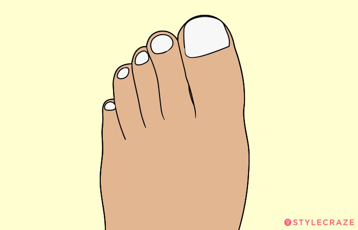 6. Extremely Small Toe