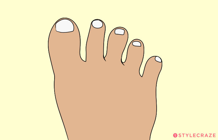 7. Toes With Wide Gaps