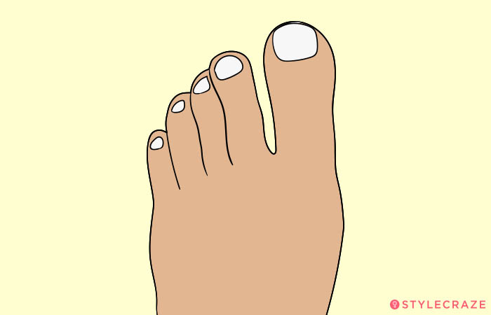 8. Stretched Toes