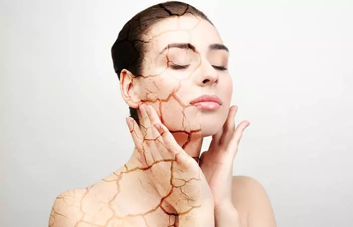 1. Dry Skin 