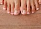 10 Remedies To Get Rid Of Ingrown Toe...