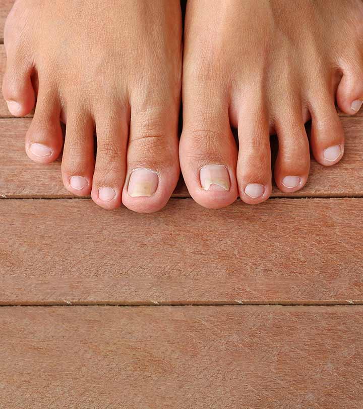 painful toenail