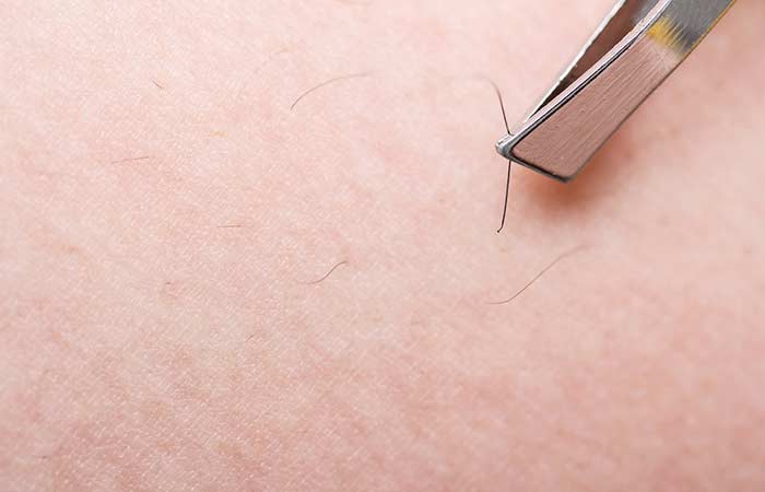 15. Plucking ingrown hairs from each other is only too common. 