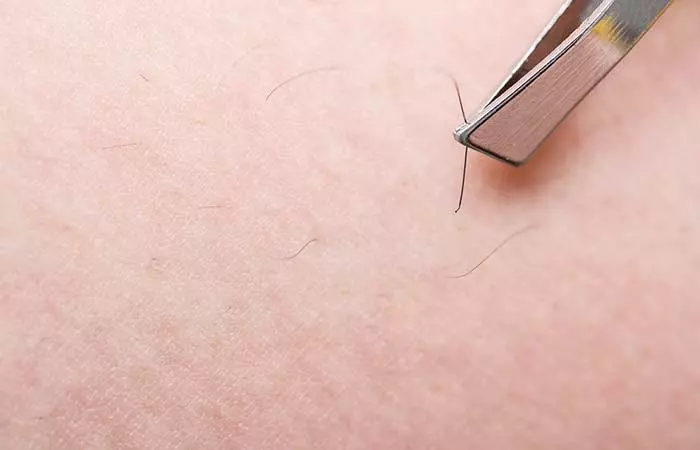15. Plucking ingrown hairs from each other is only too common. 