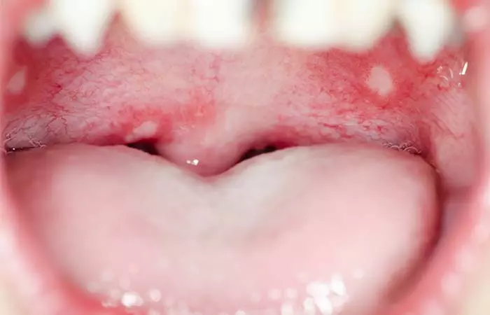 4. Blood In The Mouth 