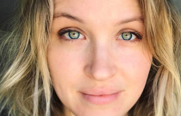 7. Her Limbal Rings