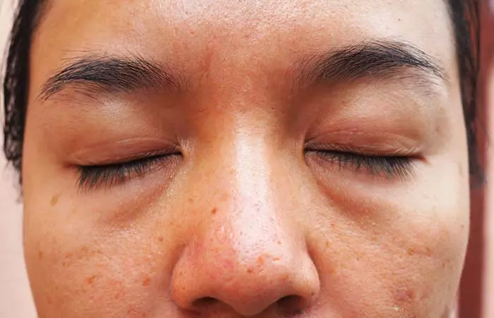 1. Dairy Skin