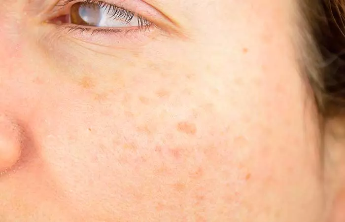 2. Gluten Skin