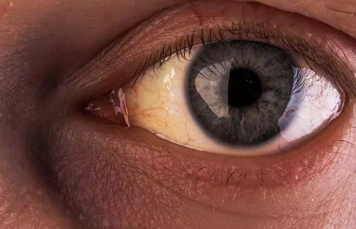 3. Yellow Eyes And Face 