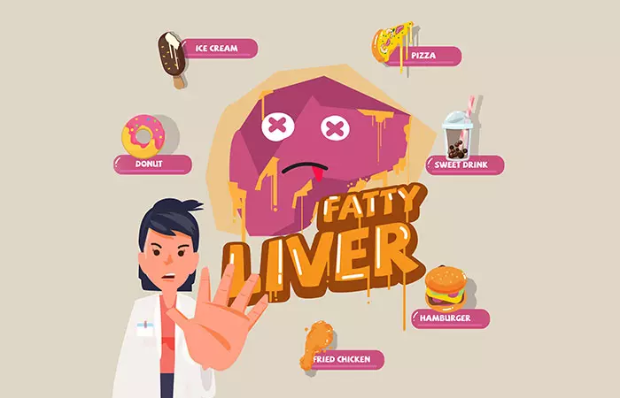 5. Fatty Liver