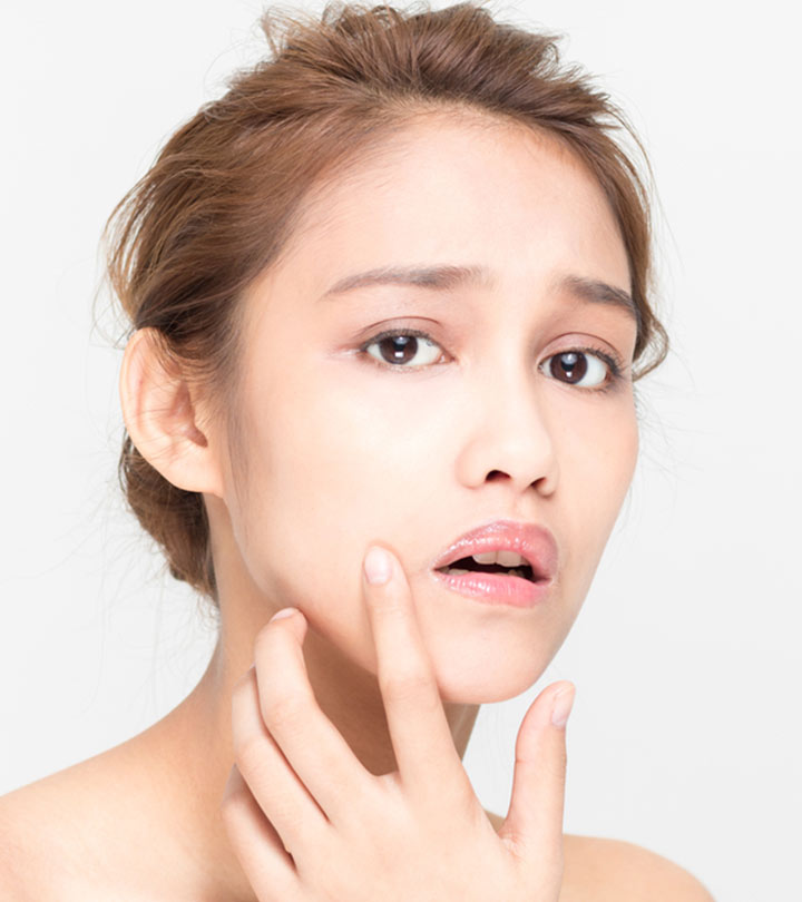 6 Symptoms Of Vitamin Deficiency That Show On Your Face