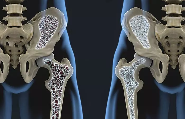 8. Your Bones Become Weaker