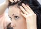 How To Treat Scabs On The Scalp The Natural Way