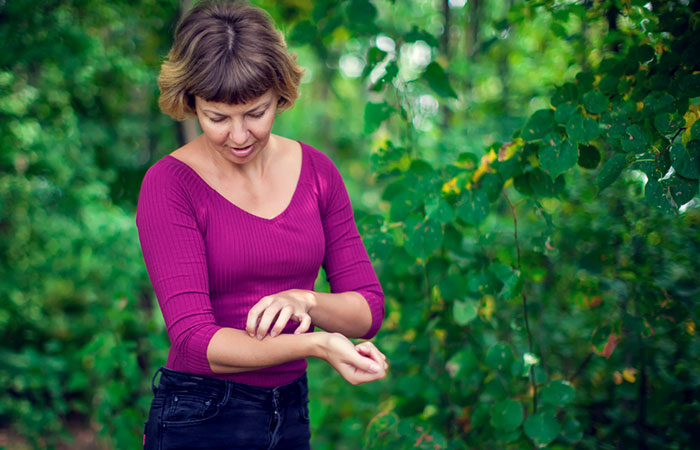 Woman scratching her hand after touching poison ivy