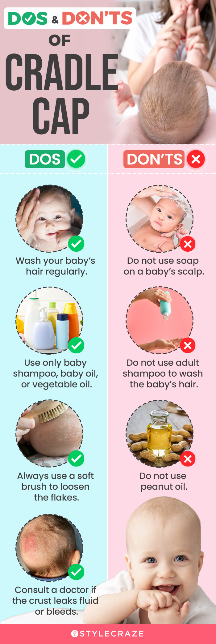 the dos and don’ts of cradle cap (infographic)