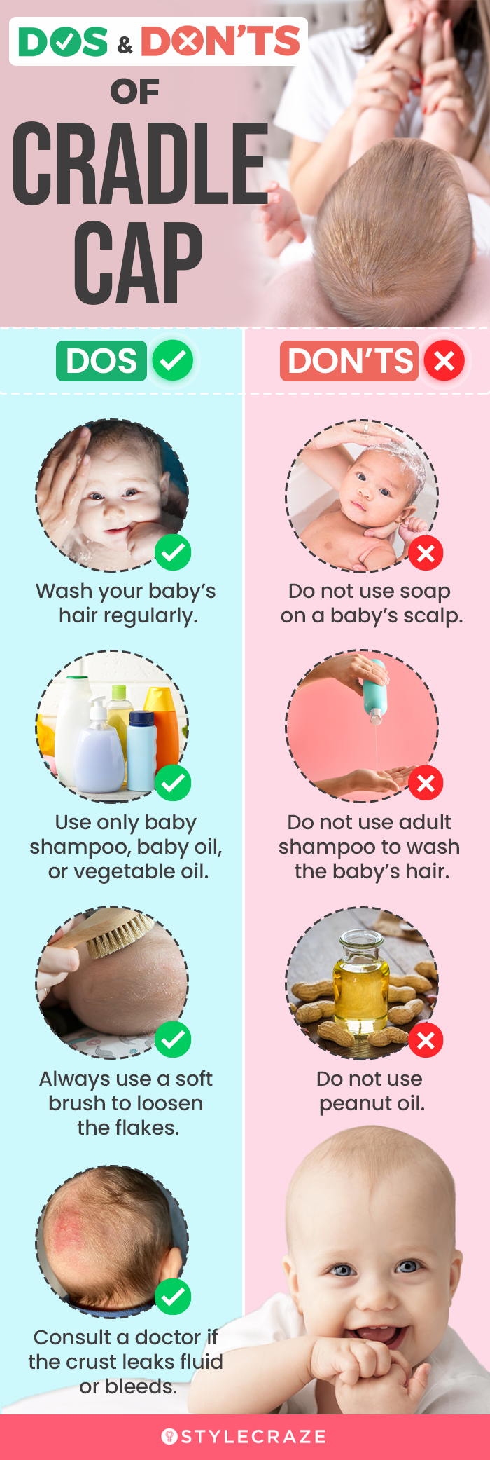 Cradle Cap What Is It? And Do You Need To Worry About It