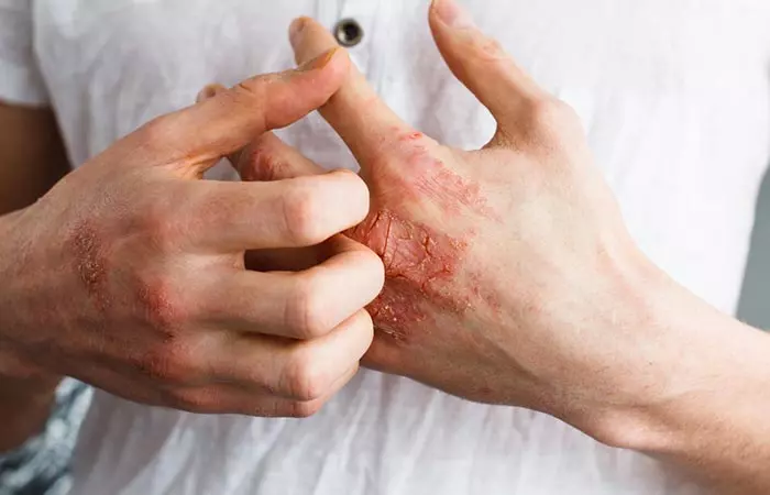 1. Skin Issues