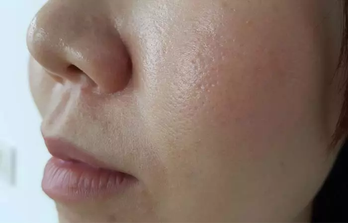 Large Pores