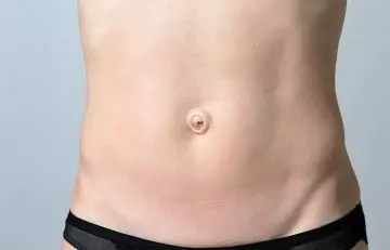 What Does An Outie Belly Button Mean