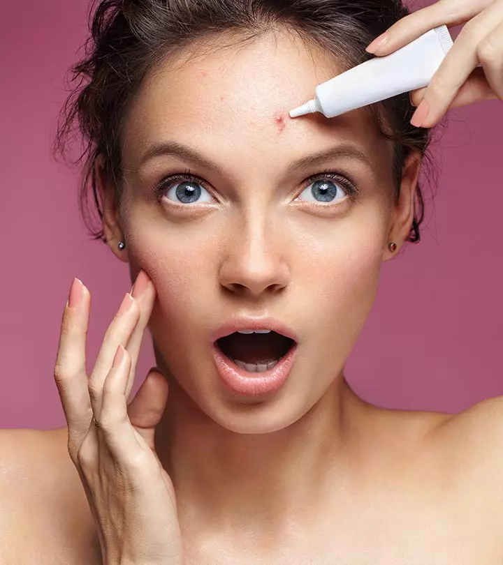 What You Don't Know About Pimples