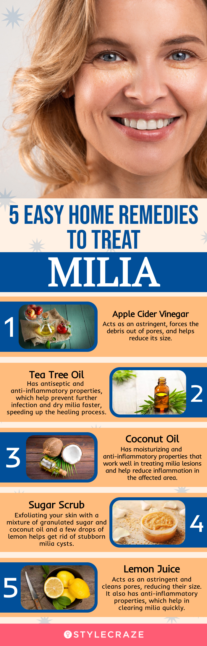 easy home remedies to treat milia [infographic]